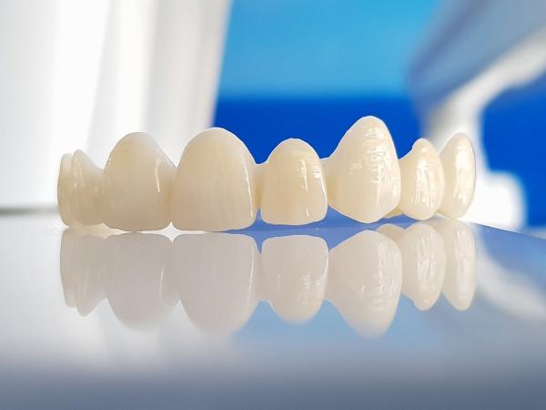 Протезирование зубов: особенности процедуры и ее преимущества